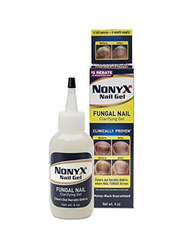 Xenna All Natural NonyX Nail Gel For Toenails and Fingernails - 4 Oz